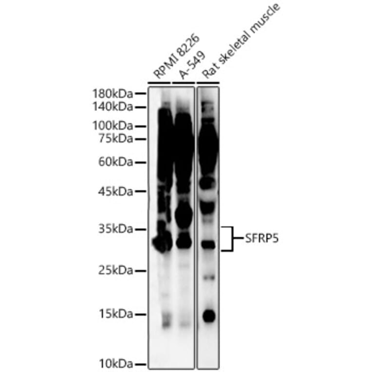 Western Blot - Anti-SFRP5 Antibody (A92719) - Antibodies.com