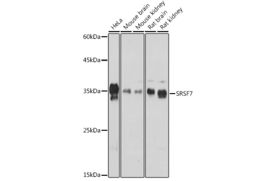 Western Blot - Anti-SFRS7/SRSF7 Antibody (A92720) - Antibodies.com