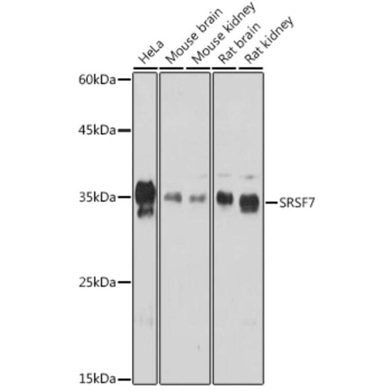 Western Blot - Anti-SFRS7/SRSF7 Antibody (A92720) - Antibodies.com