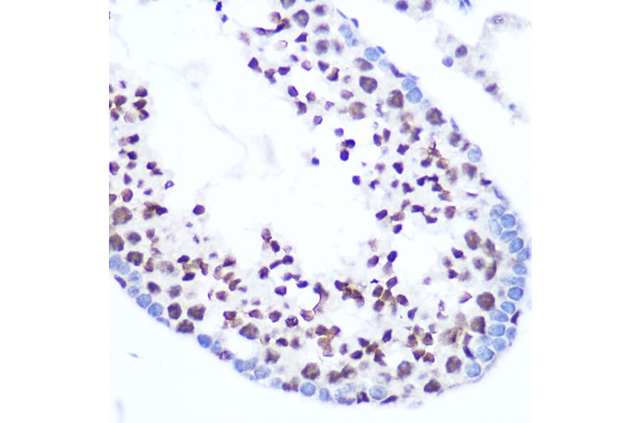 Immunohistochemistry - Anti-SFRS7/SRSF7 Antibody (A92720) - Antibodies.com
