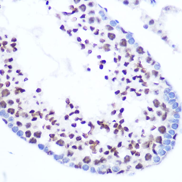 Immunohistochemistry - Anti-SFRS7/SRSF7 Antibody (A92720) - Antibodies.com