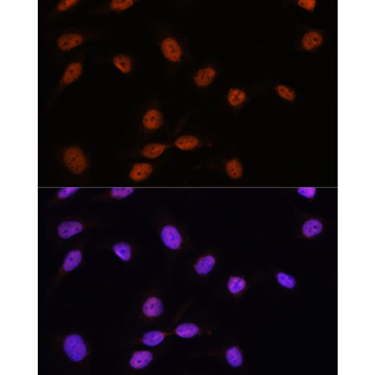 Immunofluorescence - Anti-SFRS7/SRSF7 Antibody (A92720) - Antibodies.com