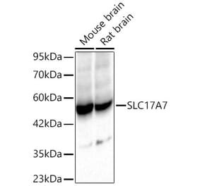 Western Blot - Anti-VGLUT1 Antibody (A92725) - Antibodies.com