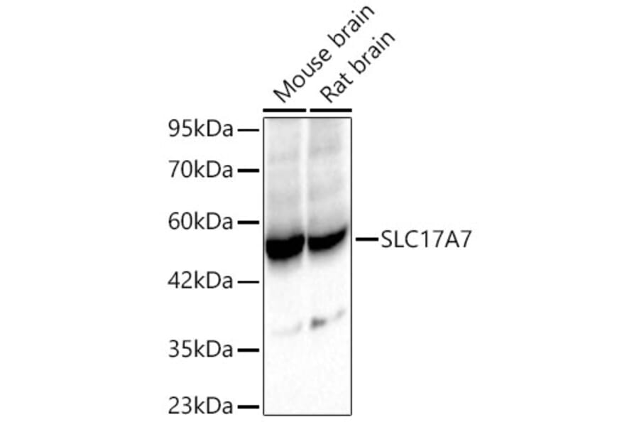 Western Blot - Anti-VGLUT1 Antibody (A92725) - Antibodies.com