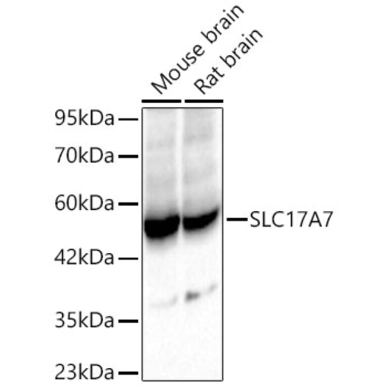 Western Blot - Anti-VGLUT1 Antibody (A92725) - Antibodies.com