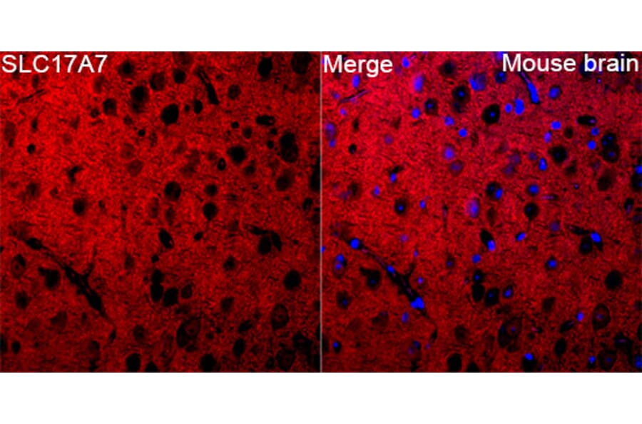 Immunofluorescence - Anti-VGLUT1 Antibody (A92725) - Antibodies.com
