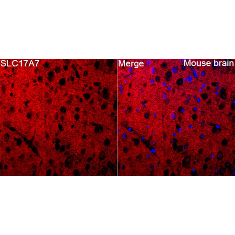Immunofluorescence - Anti-VGLUT1 Antibody (A92725) - Antibodies.com