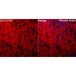 Immunofluorescence - Anti-VGLUT1 Antibody (A92725) - Antibodies.com