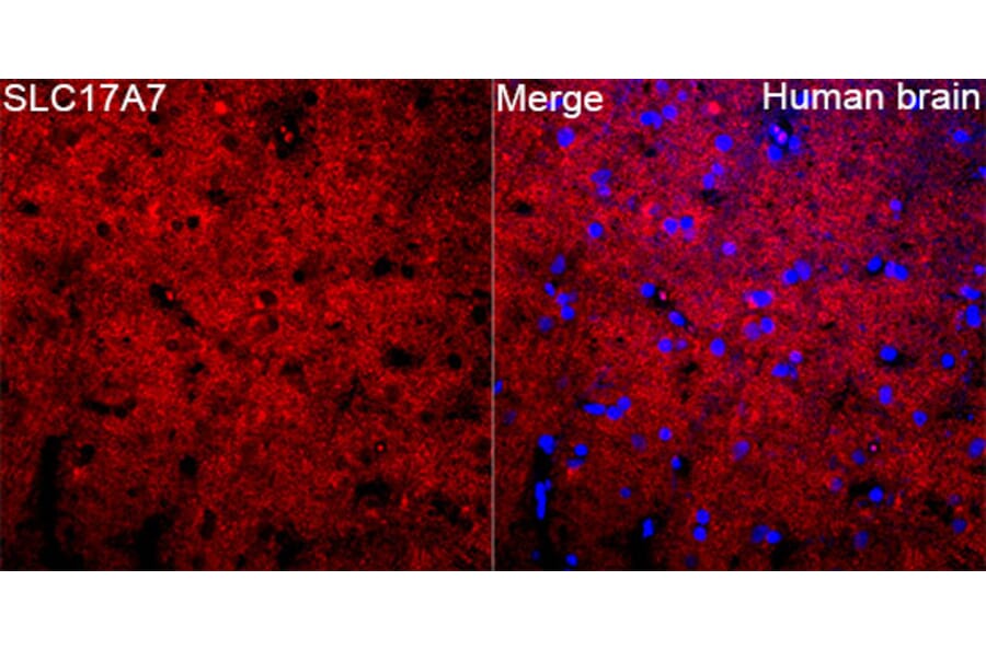 Immunofluorescence - Anti-VGLUT1 Antibody (A92725) - Antibodies.com