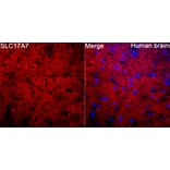 Immunofluorescence - Anti-VGLUT1 Antibody (A92725) - Antibodies.com