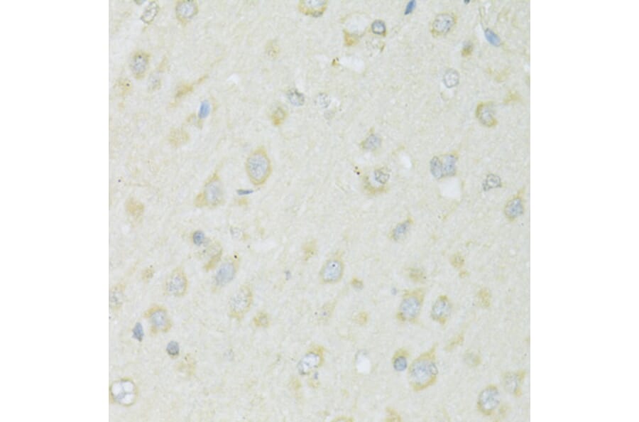 Immunohistochemistry - Anti-SLC22A5 Antibody (A14785) - Antibodies.com