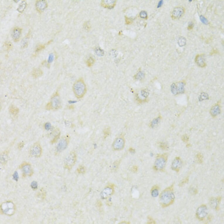 Immunohistochemistry - Anti-SLC22A5 Antibody (A14785) - Antibodies.com