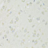 Immunohistochemistry - Anti-SLC22A5 Antibody (A14785) - Antibodies.com