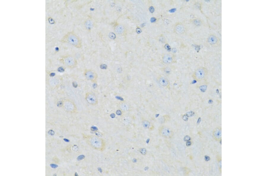 Immunohistochemistry - Anti-SLC22A5 Antibody (A14785) - Antibodies.com