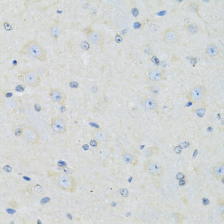 Immunohistochemistry - Anti-SLC22A5 Antibody (A14785) - Antibodies.com