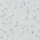 Immunohistochemistry - Anti-SLC22A5 Antibody (A14785) - Antibodies.com