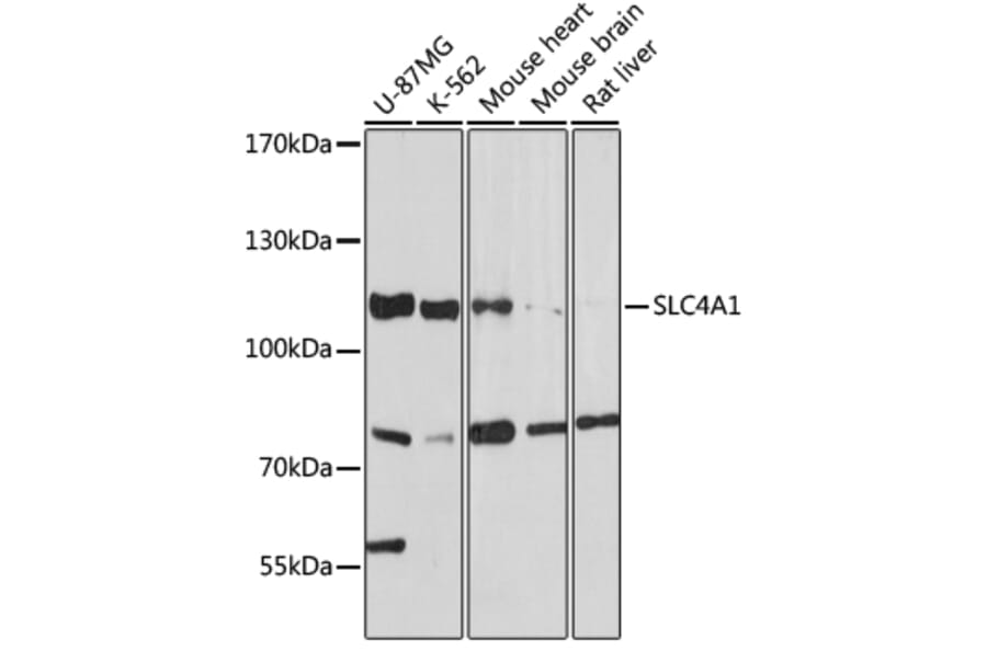 Western Blot - Anti-Band 3/AE 1 Antibody (A92727) - Antibodies.com