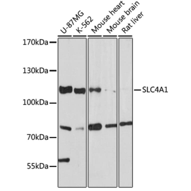 Western Blot - Anti-Band 3/AE 1 Antibody (A92727) - Antibodies.com
