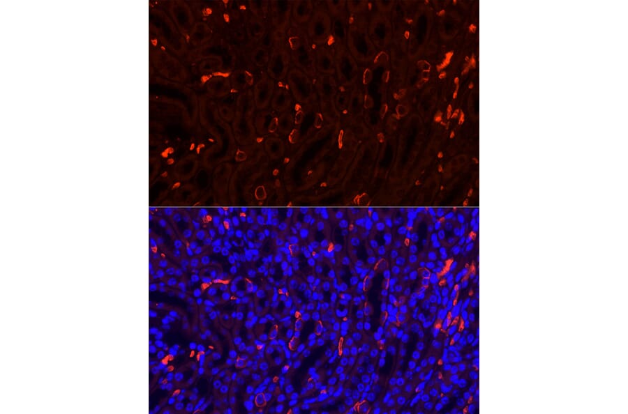 Immunofluorescence - Anti-Band 3/AE 1 Antibody (A92727) - Antibodies.com