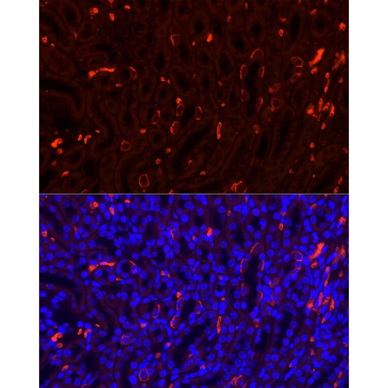 Immunofluorescence - Anti-Band 3/AE 1 Antibody (A92727) - Antibodies.com