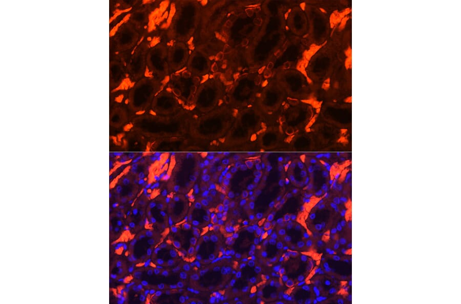 Immunofluorescence - Anti-Band 3/AE 1 Antibody (A92727) - Antibodies.com