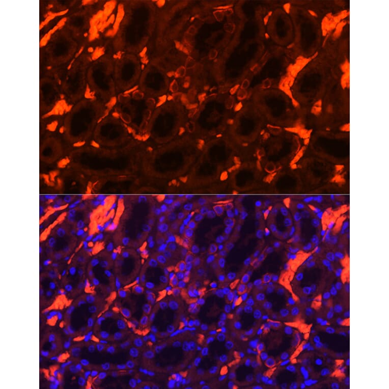 Immunofluorescence - Anti-Band 3/AE 1 Antibody (A92727) - Antibodies.com