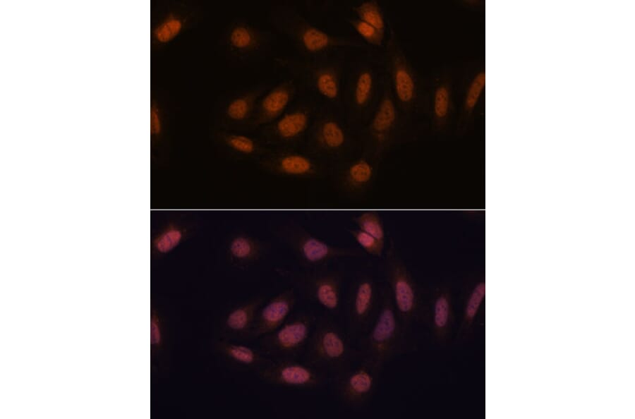 Immunofluorescence - Anti-SNIP1 Antibody (A92729) - Antibodies.com