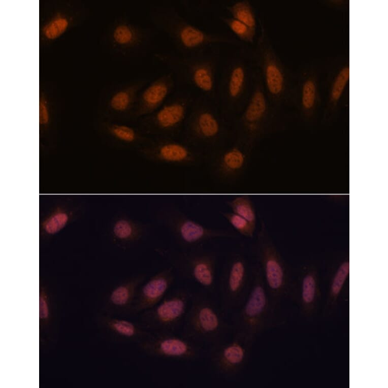 Immunofluorescence - Anti-SNIP1 Antibody (A92729) - Antibodies.com