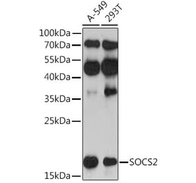 Western Blot - Anti-SOCS2 Antibody (A92731) - Antibodies.com