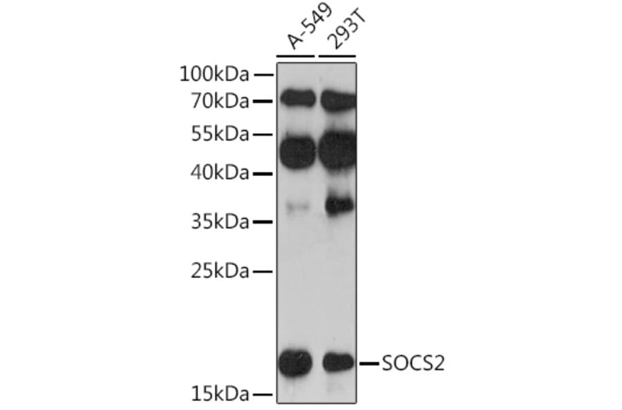 Western Blot - Anti-SOCS2 Antibody (A92731) - Antibodies.com