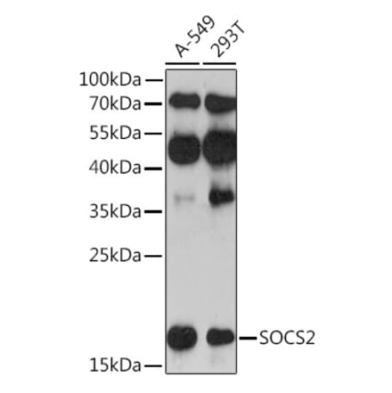 Western Blot - Anti-SOCS2 Antibody (A92731) - Antibodies.com