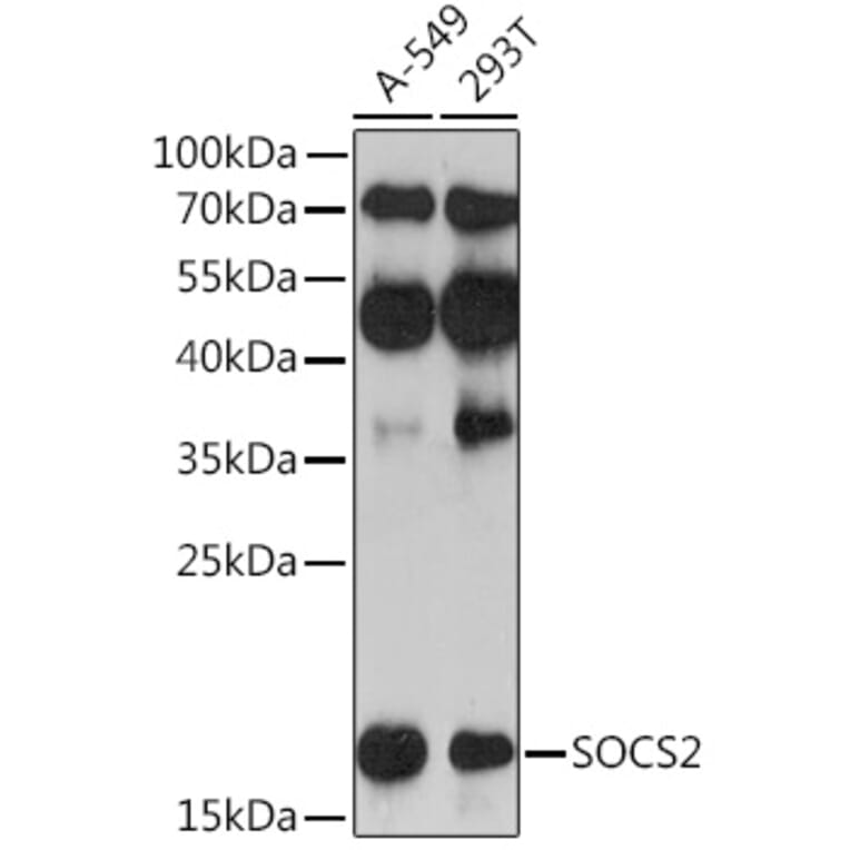 Western Blot - Anti-SOCS2 Antibody (A92731) - Antibodies.com