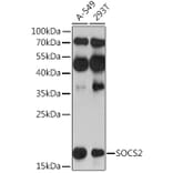 Western Blot - Anti-SOCS2 Antibody (A92731) - Antibodies.com