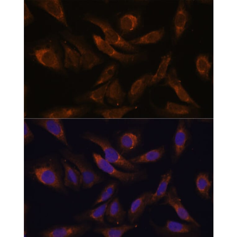 Immunofluorescence - Anti-SOCS2 Antibody (A92731) - Antibodies.com