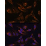 Immunofluorescence - Anti-SOCS2 Antibody (A92731) - Antibodies.com