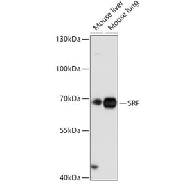 Western Blot - Anti-Serum Response Factor SRF Antibody (A92733) - Antibodies.com