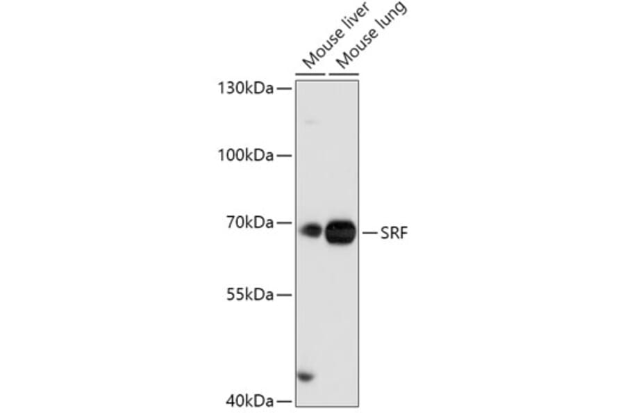 Western Blot - Anti-Serum Response Factor SRF Antibody (A92733) - Antibodies.com