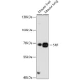 Western Blot - Anti-Serum Response Factor SRF Antibody (A92733) - Antibodies.com