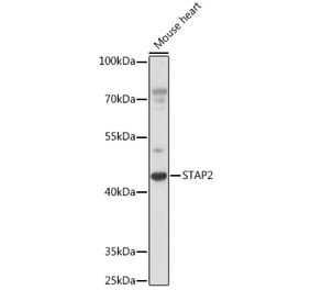 Western Blot - Anti-STAP2 Antibody (A92735) - Antibodies.com