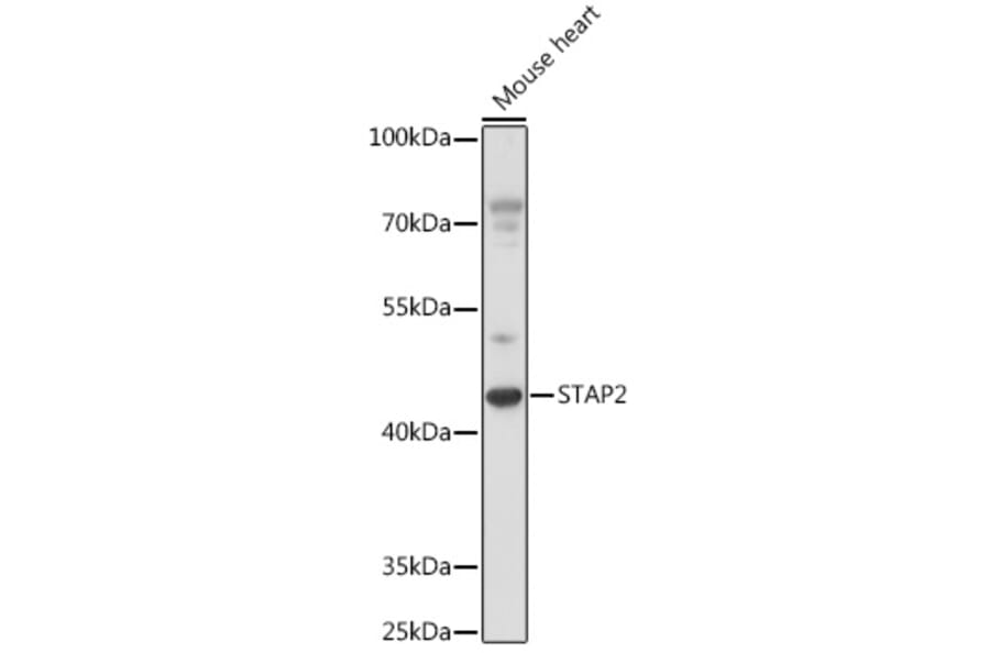 Western Blot - Anti-STAP2 Antibody (A92735) - Antibodies.com