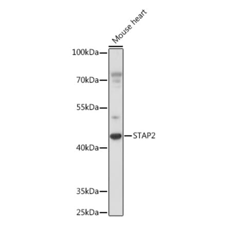 Western Blot - Anti-STAP2 Antibody (A92735) - Antibodies.com