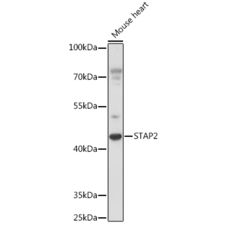 Western Blot - Anti-STAP2 Antibody (A92735) - Antibodies.com