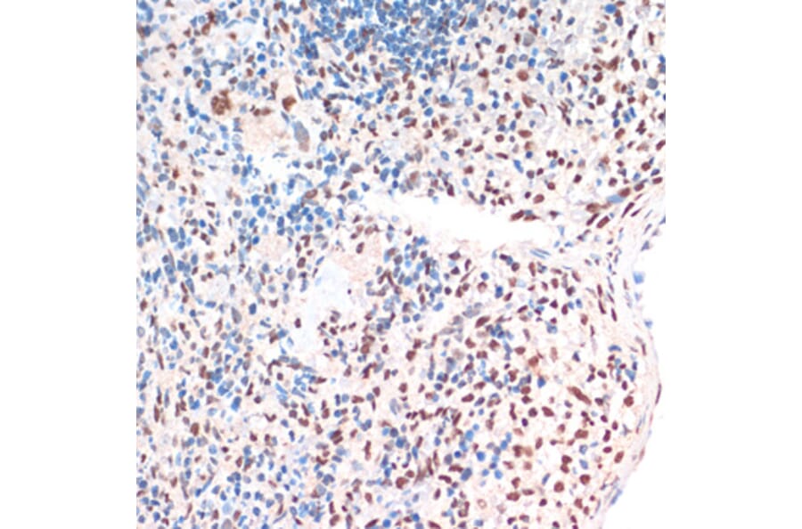 Immunohistochemistry - Anti-TDP43 Antibody (A92740) - Antibodies.com