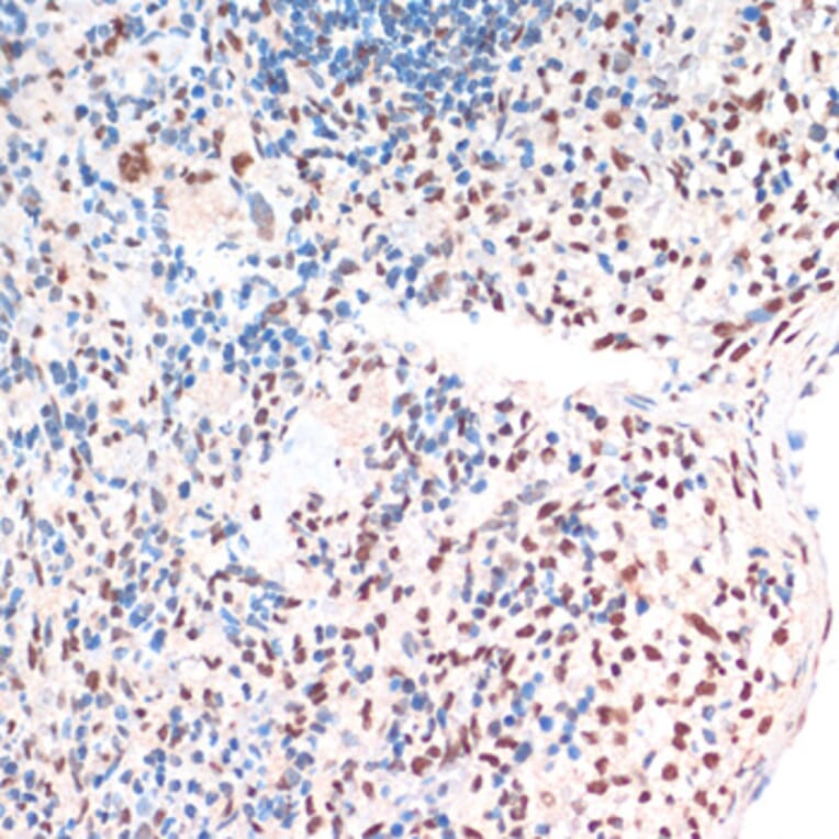 Immunohistochemistry - Anti-TDP43 Antibody (A92740) - Antibodies.com