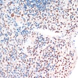 Immunohistochemistry - Anti-TDP43 Antibody (A92740) - Antibodies.com