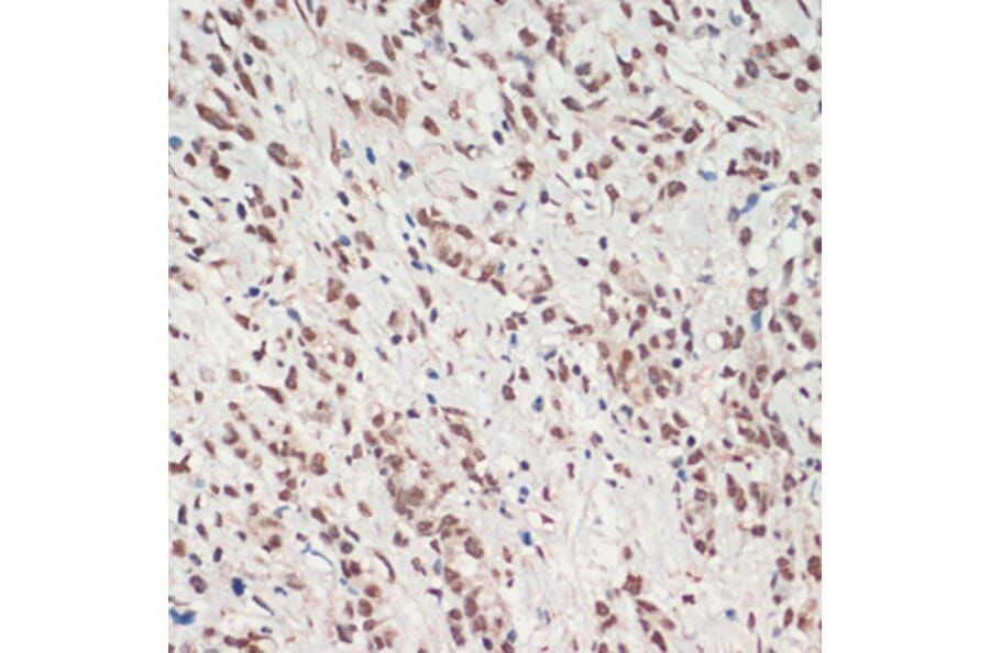 Immunohistochemistry - Anti-TDP43 Antibody (A92740) - Antibodies.com
