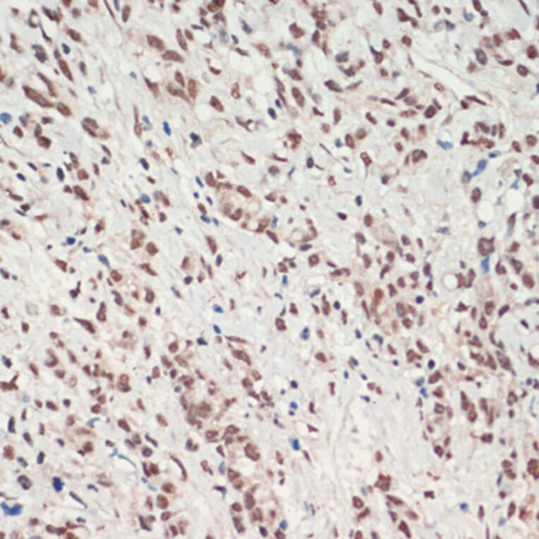 Immunohistochemistry - Anti-TDP43 Antibody (A92740) - Antibodies.com