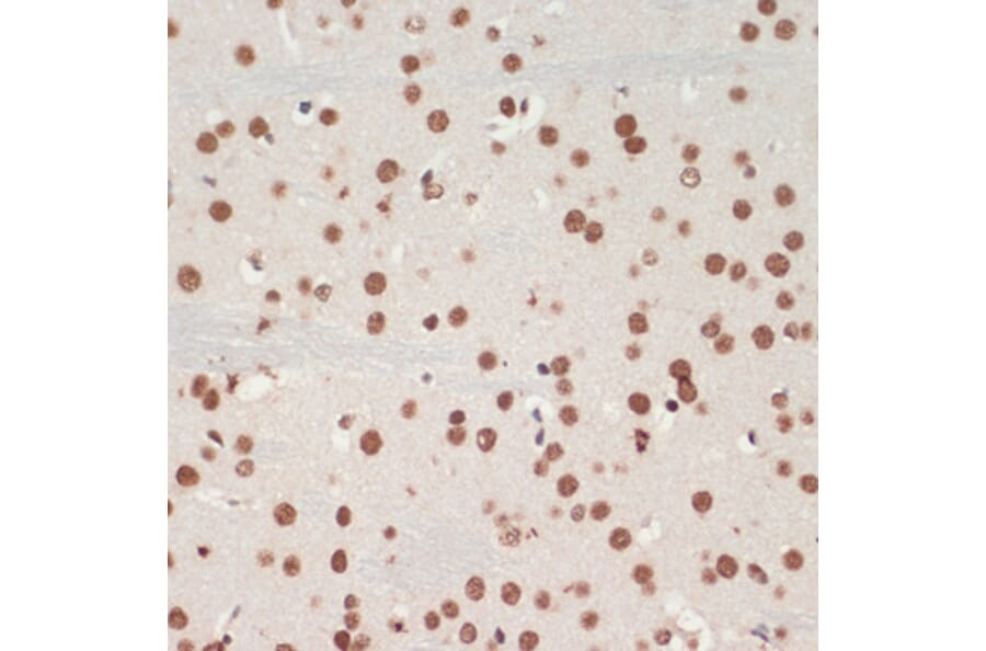 Immunohistochemistry - Anti-TDP43 Antibody (A92740) - Antibodies.com