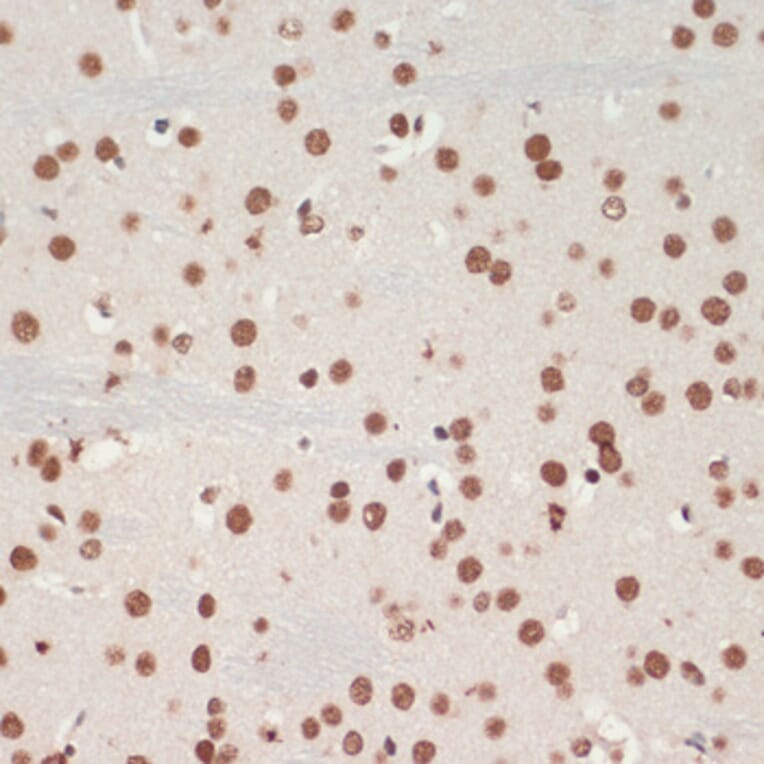 Immunohistochemistry - Anti-TDP43 Antibody (A92740) - Antibodies.com