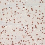 Immunohistochemistry - Anti-TDP43 Antibody (A92740) - Antibodies.com